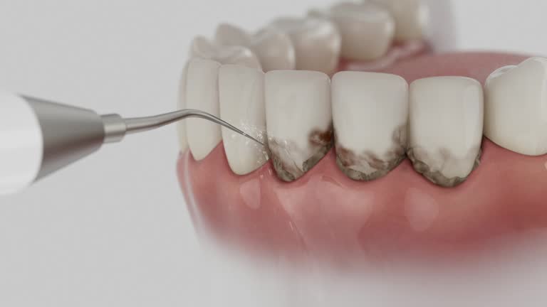 Reliable Dental Implants contractor in Manistee, MI by Smile Center Dentistry